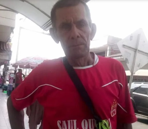 El señor Abraham Velásquez, conocido vendedor de cocos en Aguachica sufrió un accidente de tránsito